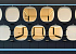 44